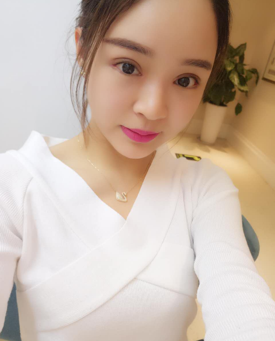 美萊案例王曉航對(duì)比圖后