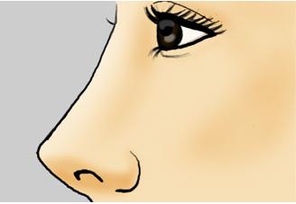 <a href='/cq/' target='_blank'><u>重慶美萊</u></a>玻尿酸隆鼻價(jià)格貴嗎？