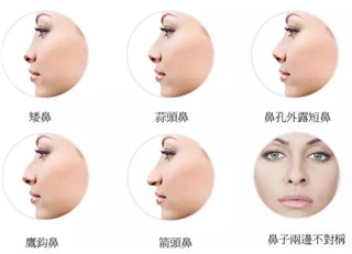 打玻尿酸鼻子會(huì)變寬，是不是真的？