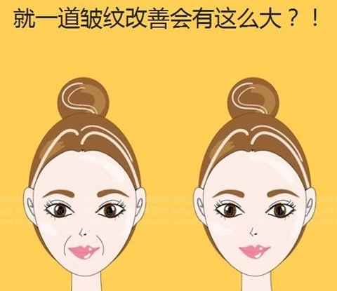 打一次玻尿酸能維持多長時(shí)間