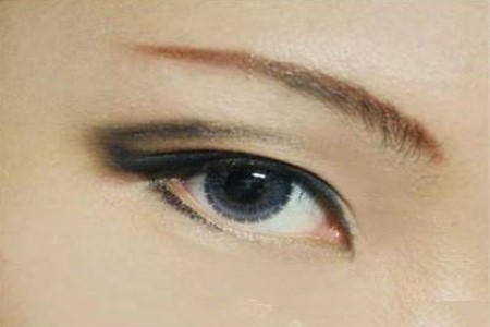 沈陽做雙眼皮術(shù)后恢復有哪些方法恢復較快