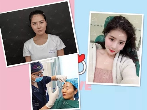 開搶丨重慶美萊多款項目2折起，玻尿酸、玻尿酸、抽脂針任性抽！