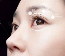重慶常用的雙眼皮整形方法有哪些？