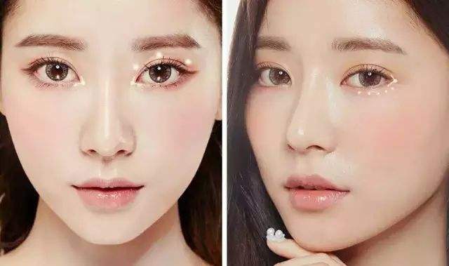 天津美萊做雙眼皮好不好？