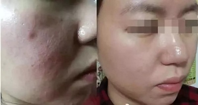 <a href='/sy/' target='_blank'><u>沈陽美萊</u></a>：嬰兒針是讓我的皮膚和嬰兒一樣白白嫩嫩？