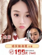福州美萊價值9.9水密碼、199玻尿酸拼團(tuán)開啟！