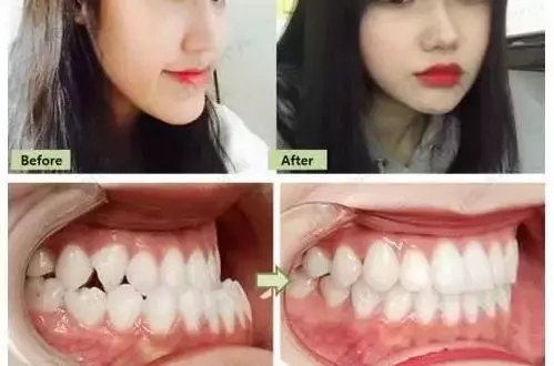 想要自信笑容，就來<a href='/suz/' target='_blank'><u>蘇州美萊</u></a>牙科
