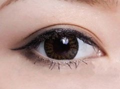 眼袋和臥蠶的區(qū)別？