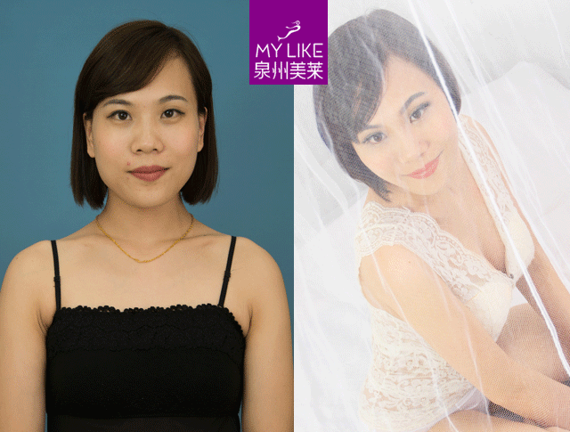 泉州美萊說：喂完下一代，酥胸變布袋？怎么解決