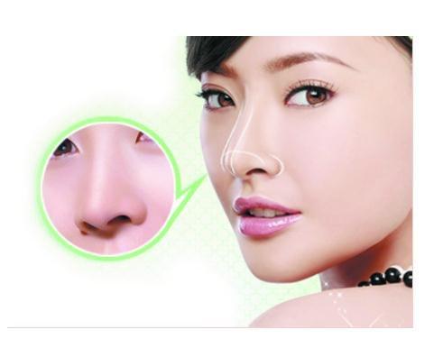 天津假體隆鼻可以保持一輩子嗎？