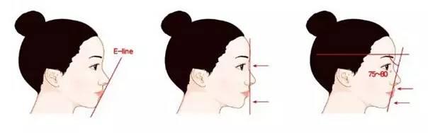 重慶做開(kāi)眼角之后不能吃哪些東西？