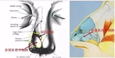 『雙側(cè)耳軟骨鏡像移植』男友“捏鼻殺”是什么感覺？