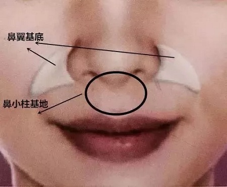 美萊幫你拯救嘴唇上方凹的這個部位