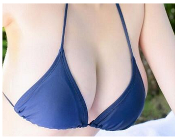 杭州做自體脂肪隆胸術(shù)創(chuàng)傷大嗎？