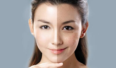 怎樣縮小毛孔？