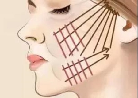 圍觀| 僅靠一條線，如何提升你的下垂臉？！