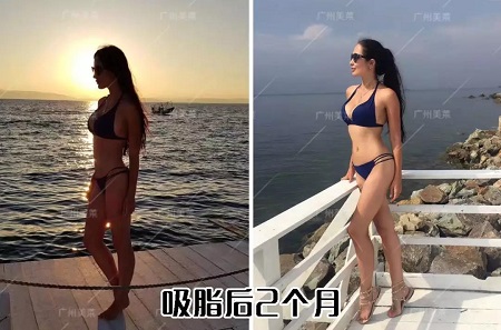瘦腿很難嗎？1招教你變身筷子腿！