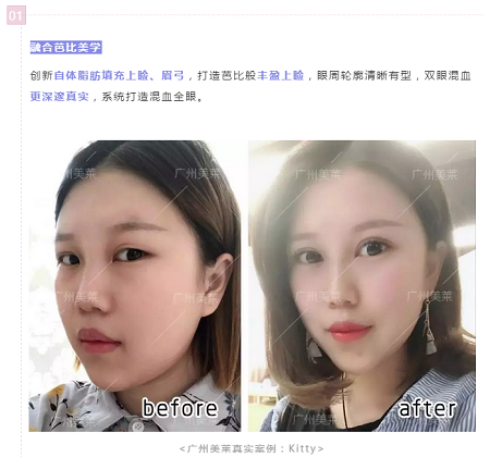 腫眼泡？重內(nèi)眥？學會這幾招，秒get混血美眼！
