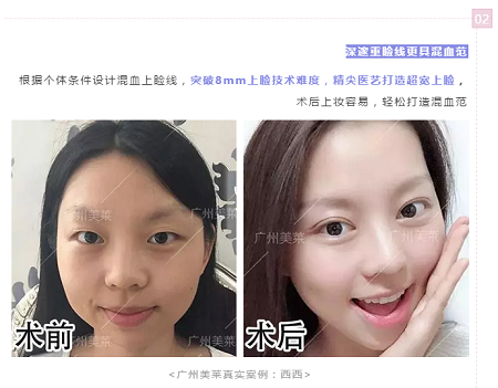 腫眼泡？重內(nèi)眥？