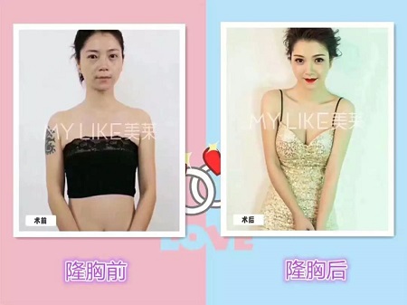 “南韓腿精”的胸也太過分了吧！