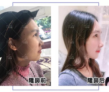 從萬人嫌到萬人迷，只悄悄變了這個(gè)部位？