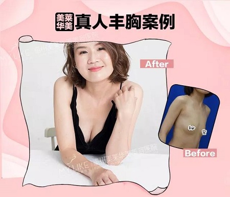 “從小喝到大”的椰汁能豐胸？