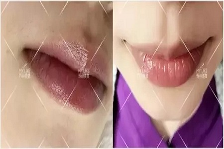 想過嗎？為啥有人的體毛多有的人少？