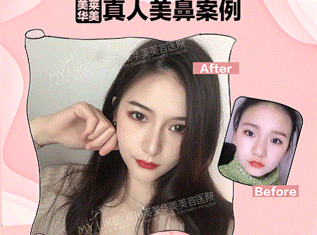 她曾丑到無人問津，現(xiàn)在卻擁有魔鬼身材，簡直是“行走的美人魚”