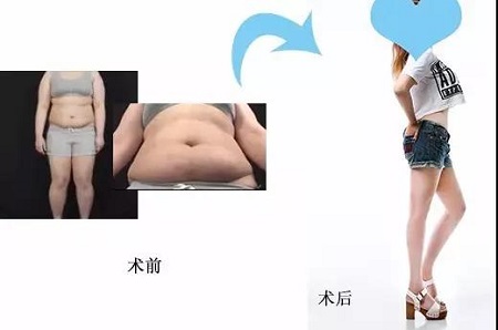瘦1圈就像瘦30斤，這真的不是開玩笑！