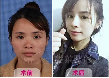 長著一張“大媽臉”的她，卻比喬妹還能收割男神？！