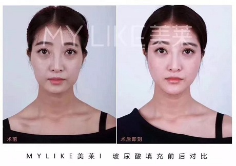 卻比喬妹還能收割男神？！