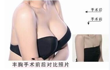 <a href='/tj' target='_blank'><u>天津整形</u></a>隆胸手術(shù)多少錢？