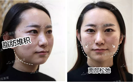 素顏邋遢老態(tài)，被嘲貴圈“照騙”！