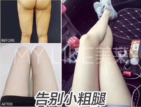 簡(jiǎn)單幾招瘦小肚子，火速收藏！