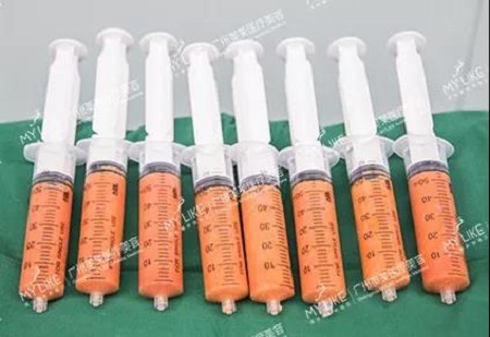 瘦出4個胸是新性感標準？