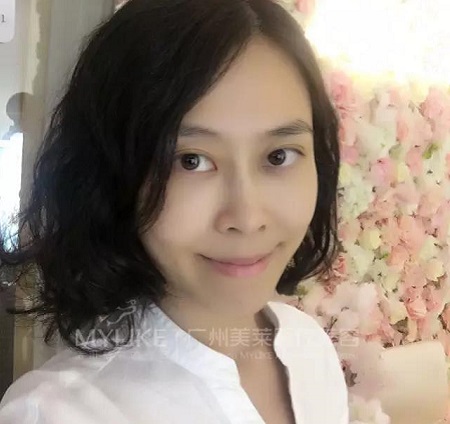 10分鐘打玻尿酸，即刻效果驚人！