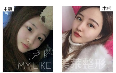 美萊特邀整形醫(yī)師—卜勝利主任，3月4日親診石家莊美萊。