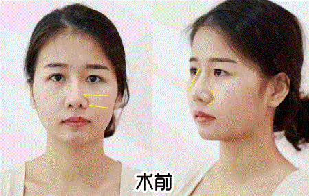 換對(duì)鼻子宛如換了一張臉，