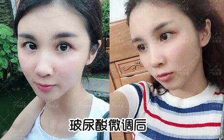 阿姨臉化身顏值擔(dān)當(dāng)，微調(diào)效果到底有多美？