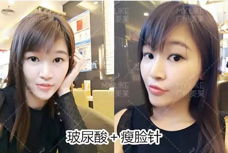 微調(diào)效果到底有多美？