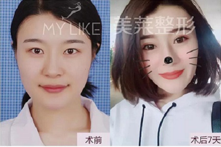 有圖有真相！每一個(gè)單眼皮的妹子都是潛力股~