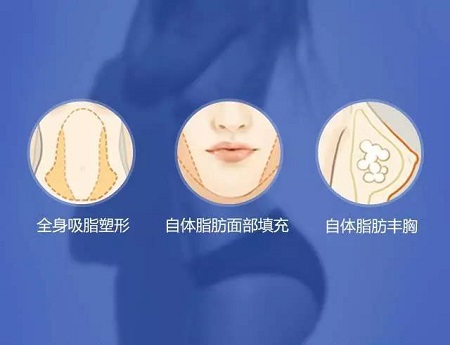 3月10、27、28日，世界吸脂勝者王志軍來了！
