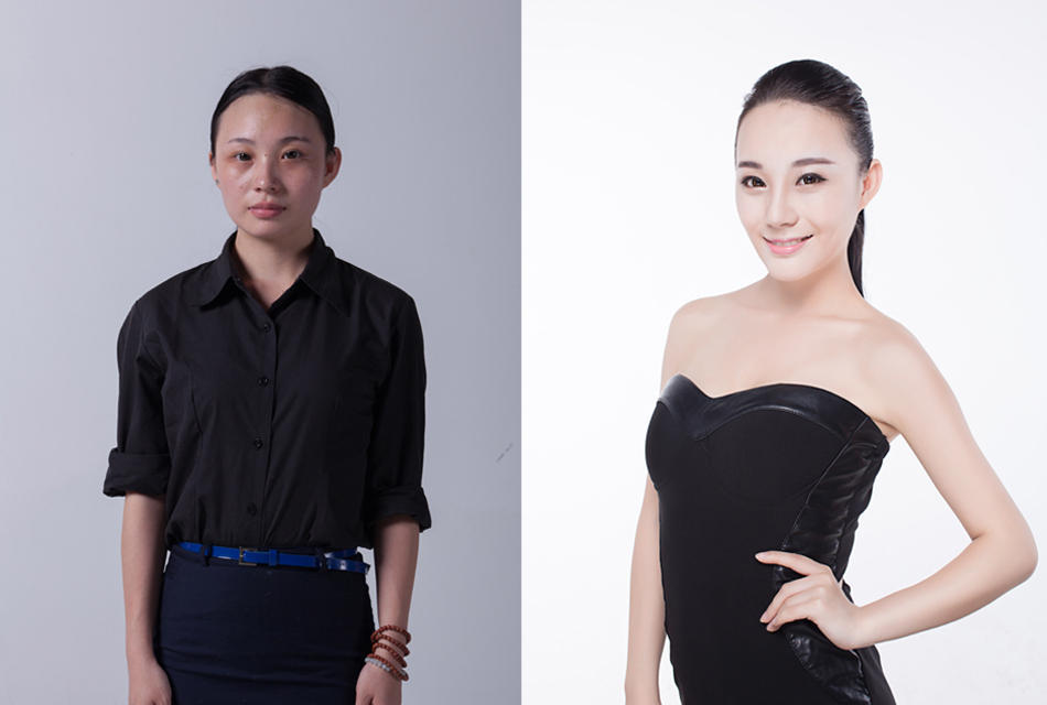 昆明玻尿酸的價(jià)格是多少？