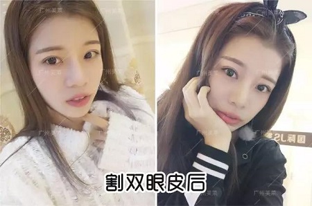 唱跳俱佳的她，割雙眼皮后都可以出道了！