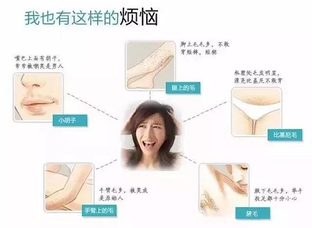脫毛年卡38元起 |脫掉尷尬,秀出迷人好身材！