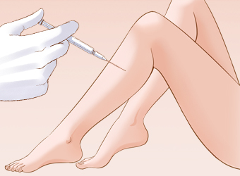 瘦腿的價(jià)格？
