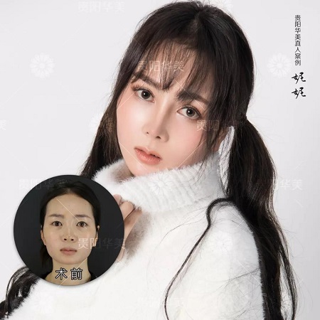 會縫衣服就會割雙眼皮！
