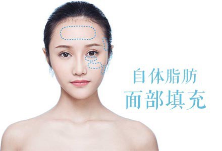 抽脂填充價(jià)格是多少？