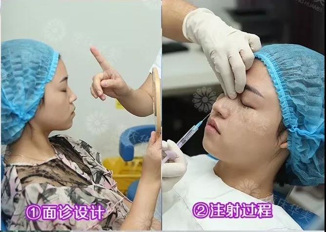 自測(cè) | 30秒就知道你適不適合打玻尿酸！