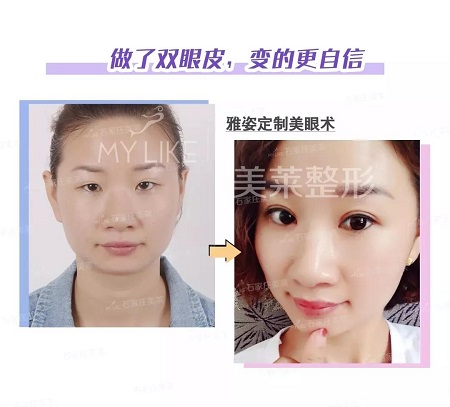 注意啦！這些眼睛一點都不招人喜歡！